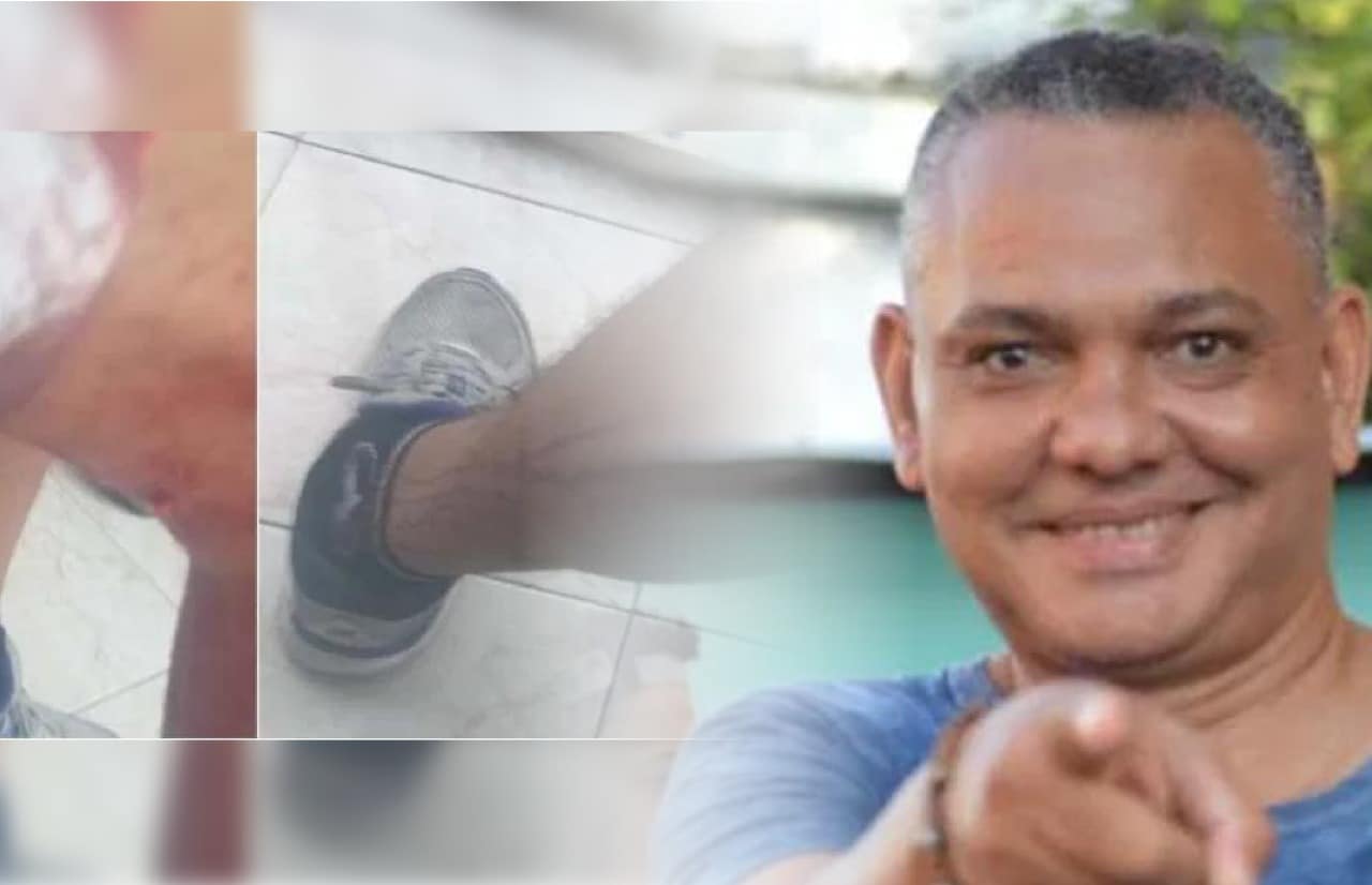 Periodista dominicano recibe una golpiza por realizar cobertura