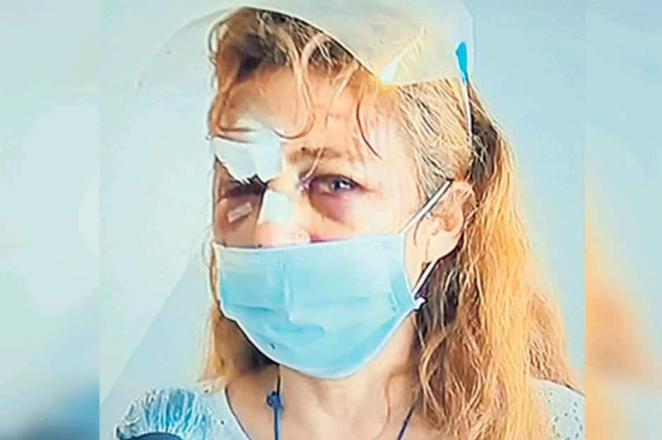 Comunicadora mexicana fue agredida brutalmente en Perú